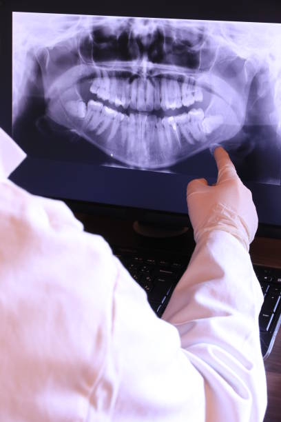 Best Emergency Tooth Extraction in Fetters Hot Springs Agua Liente, CA