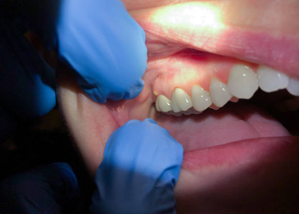  Fetters Hot Springs Agua Liente, CA Emergency Dentist Pros