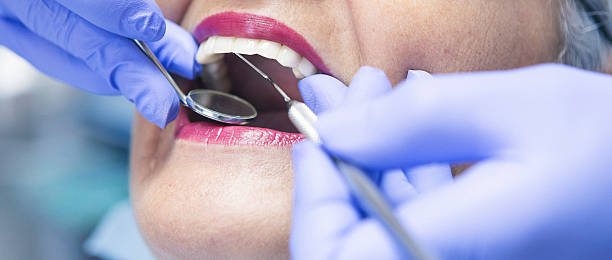 Best Emergency Treatment for Dental Infections or Abscesses in Fetters Hot Springs Agua Liente, CA